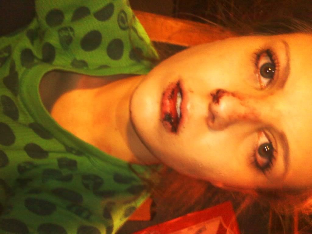 Original personal archive photograph from age 18 showing the aftermath of physical abuse