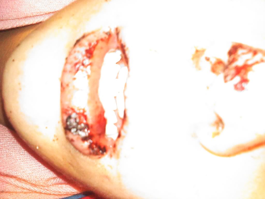 Original personal archive photograph from age 18 showing the aftermath of physical abuse